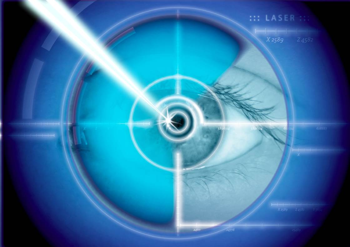 Eye laser correction stock photo